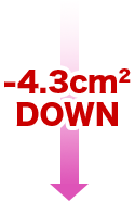 -4.3㎠DOWN